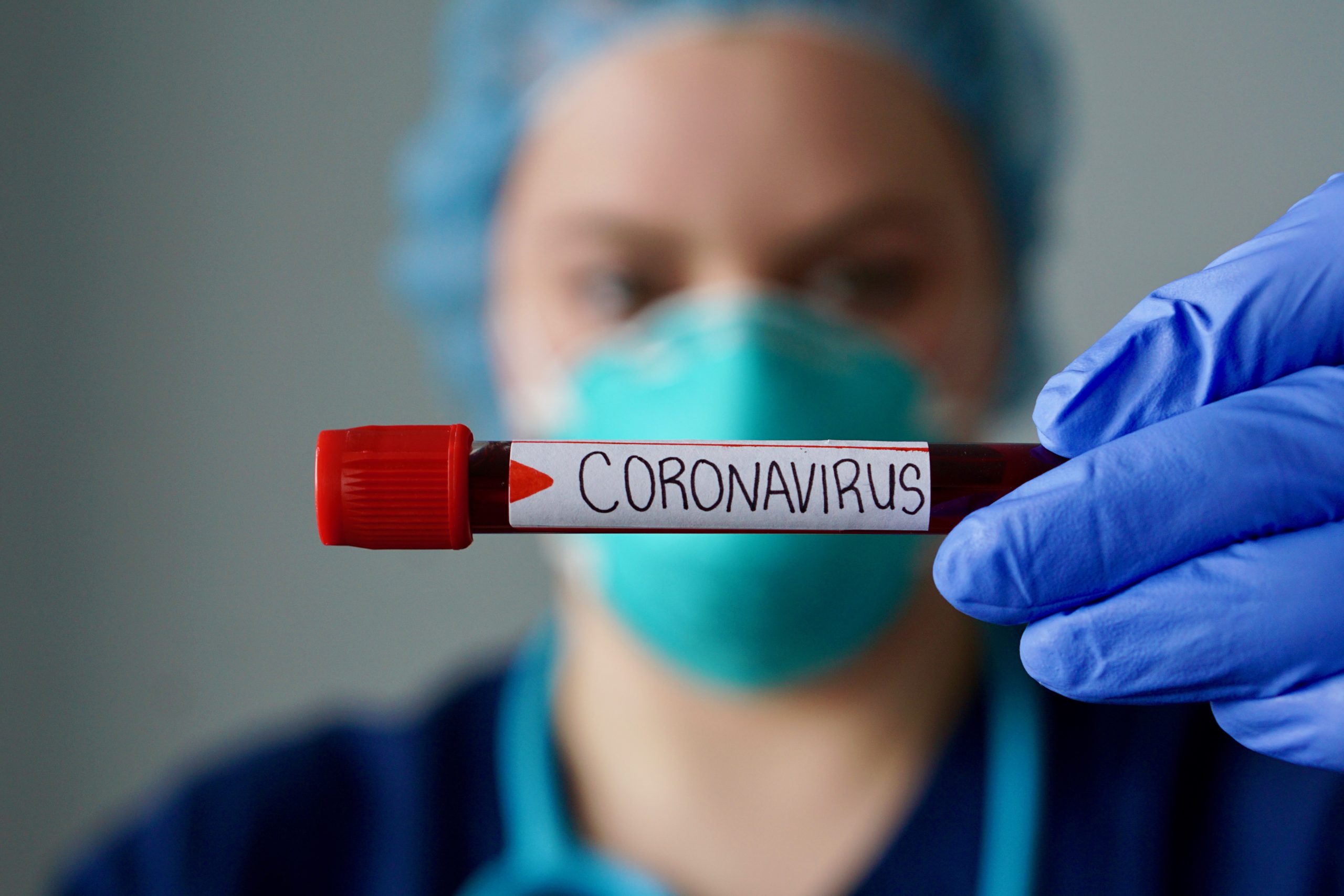 Autônomos já podem se cadastrar em sistema que testa contra coronavírus